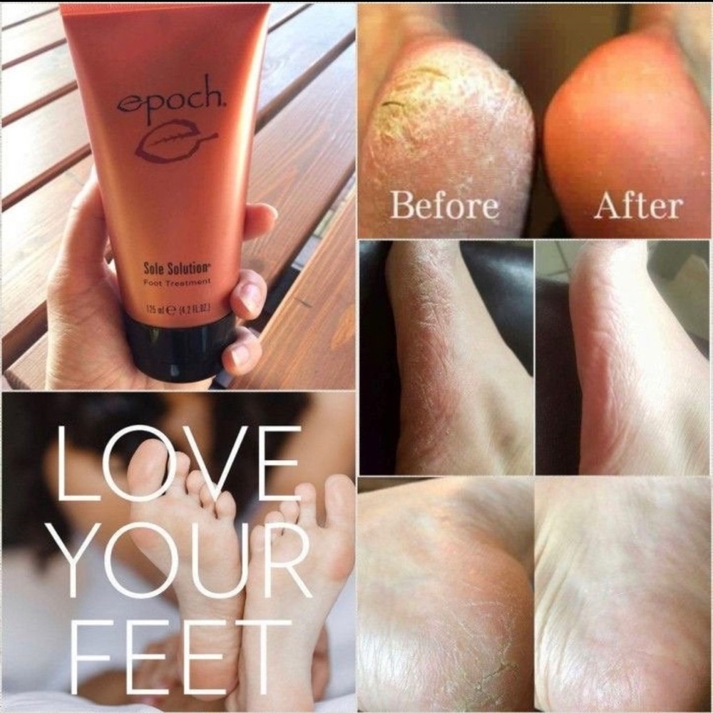 Epoch Sole Solution Foot Treatment (Pedi in a Tube)